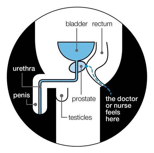 brenda christenson recommends nurse gives prostate exam pic