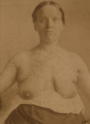curtis storer add women nipple photos photo