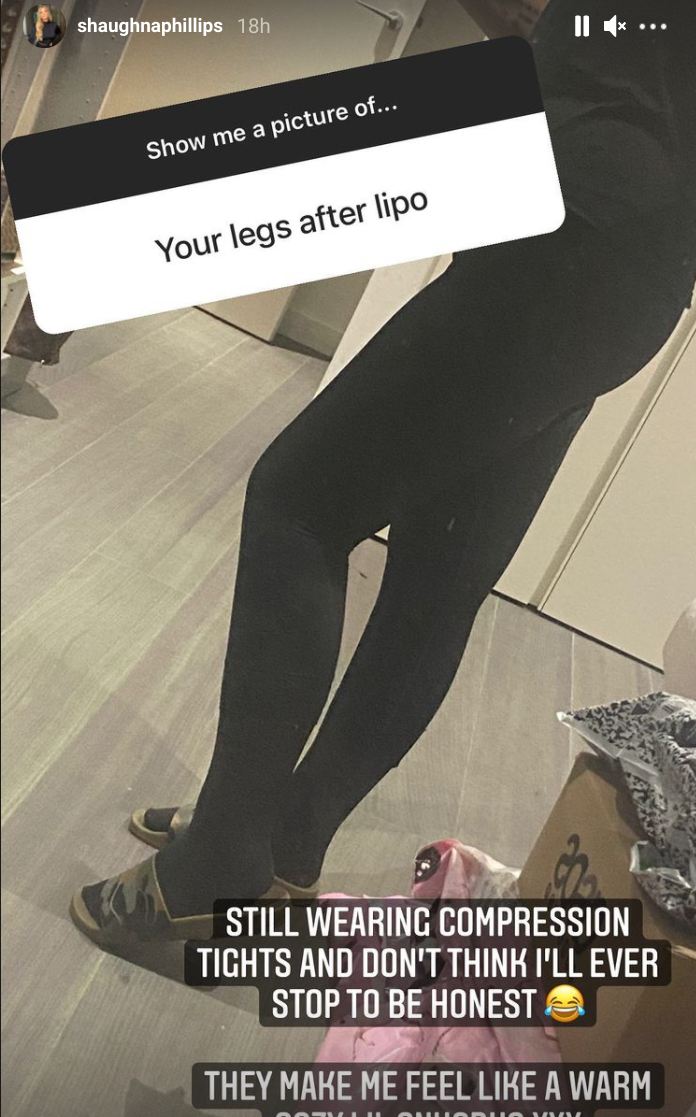 show me your legs