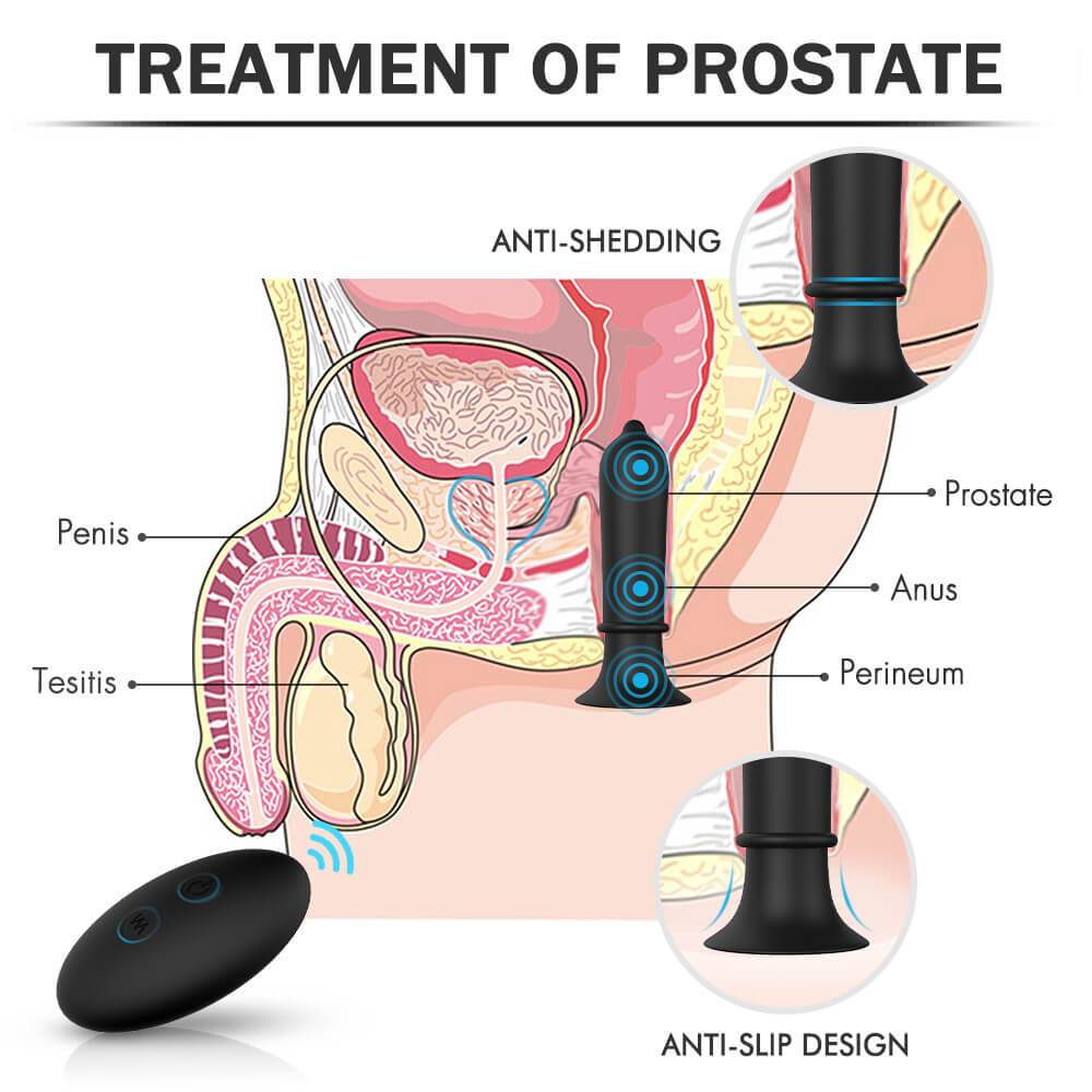 corny neufeld add photo reddit prostate play