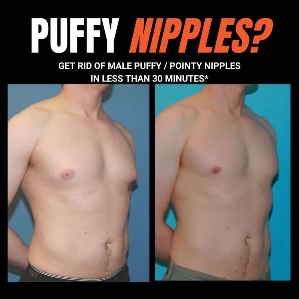 small puffy nipples