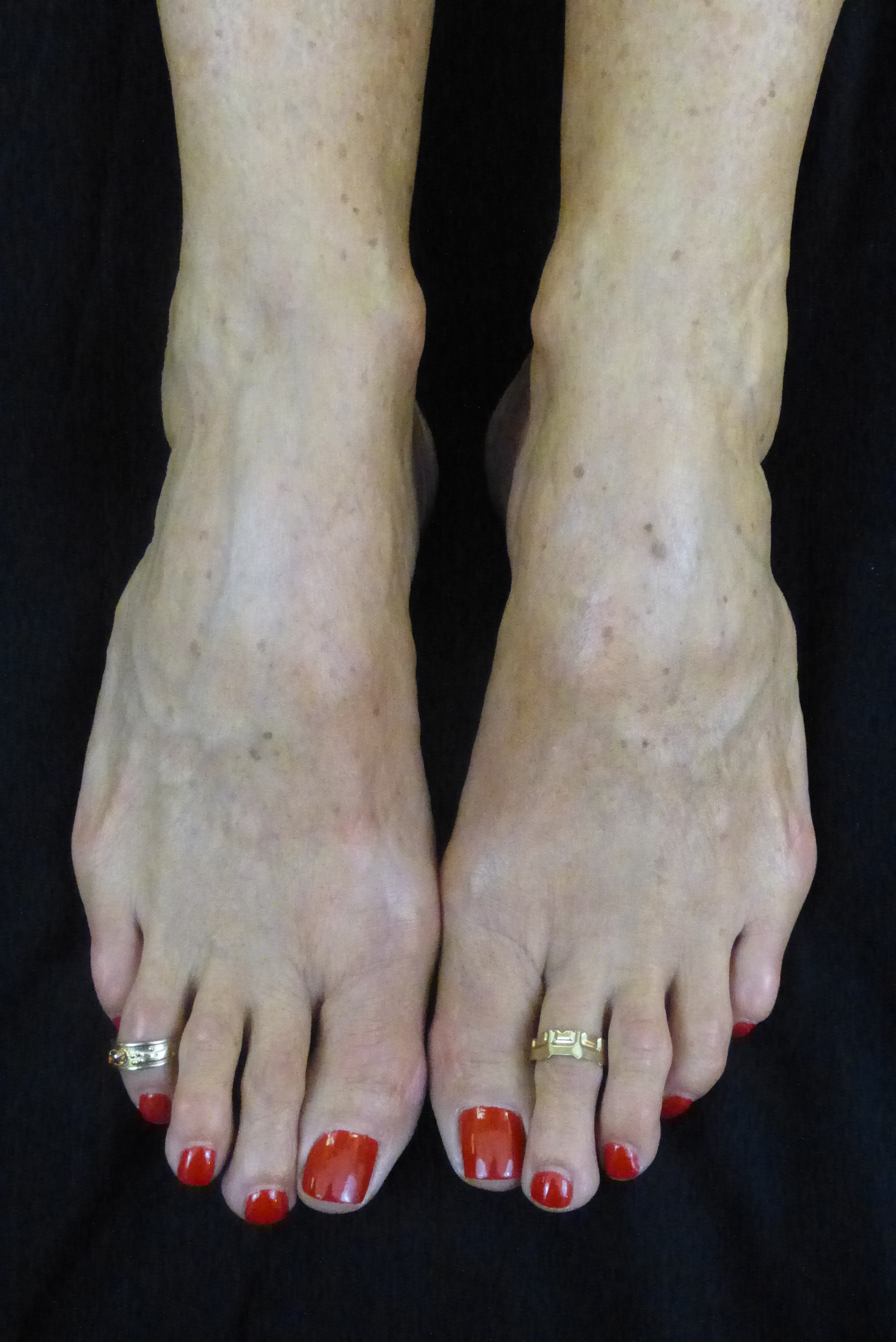 chandra arifin recommends sally d angelo feet pic