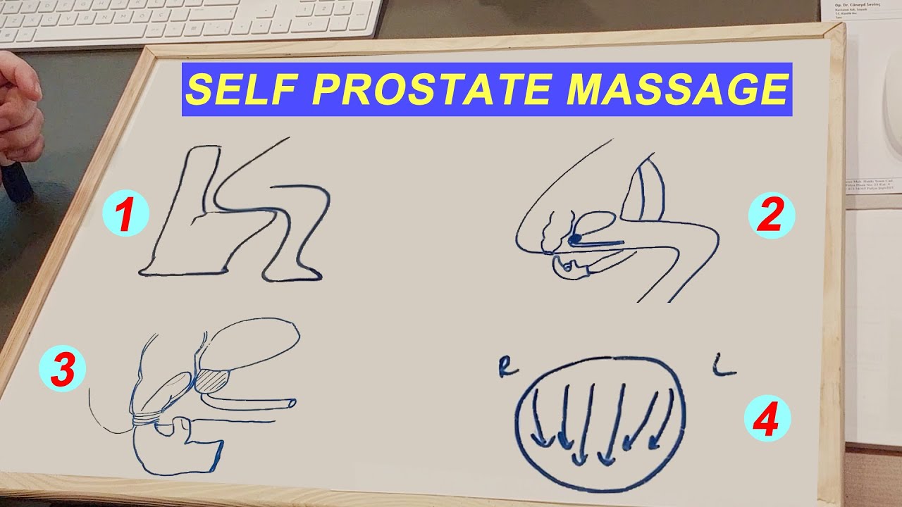 derrick dean recommends prostate massage instructional video pic