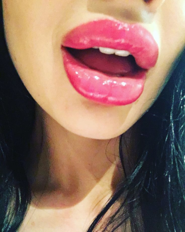 Best of Huge fake lips tumblr