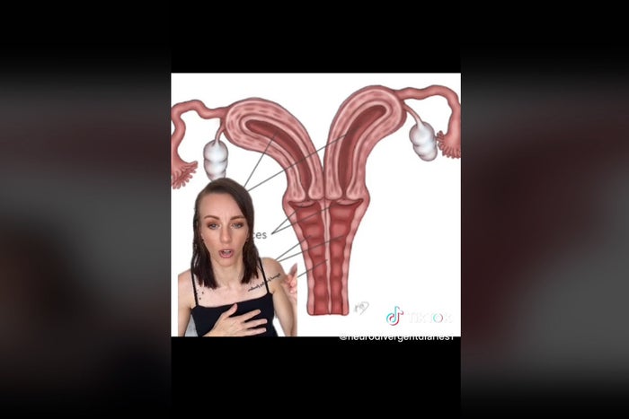 christian catindig recommends Woman With Two Vaginas Picture