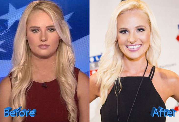 barbara pleau share tomi lahren fake boobs photos