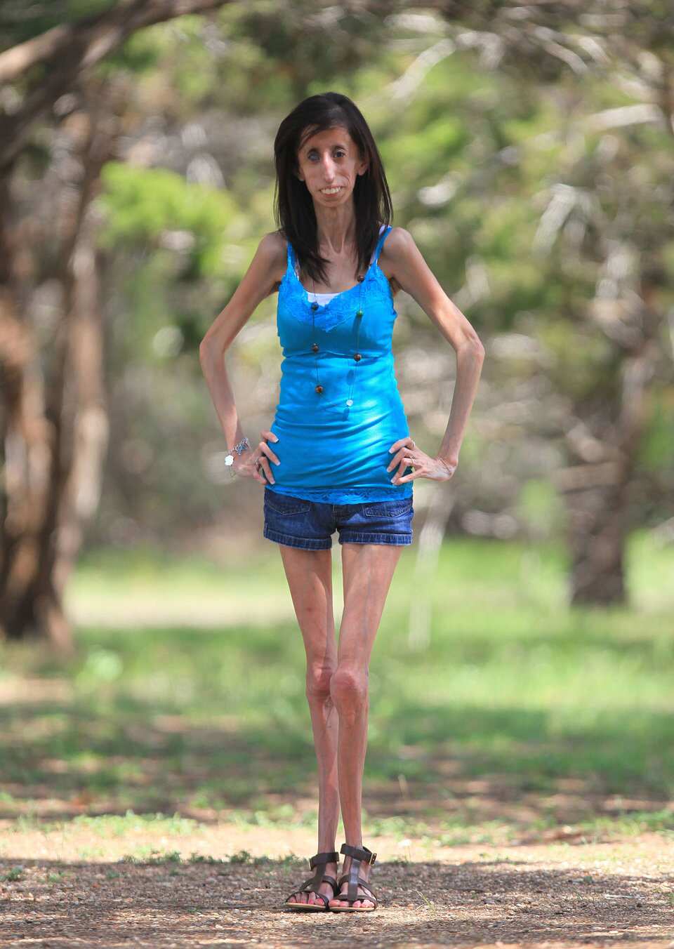 Best of Skinniest girl on earth