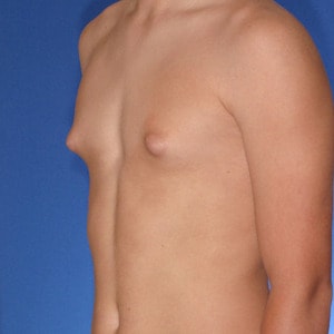 charles dunphy add small puffy nipples photo