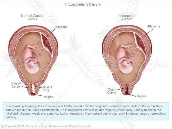 Best of Hitting the cervix good or bad