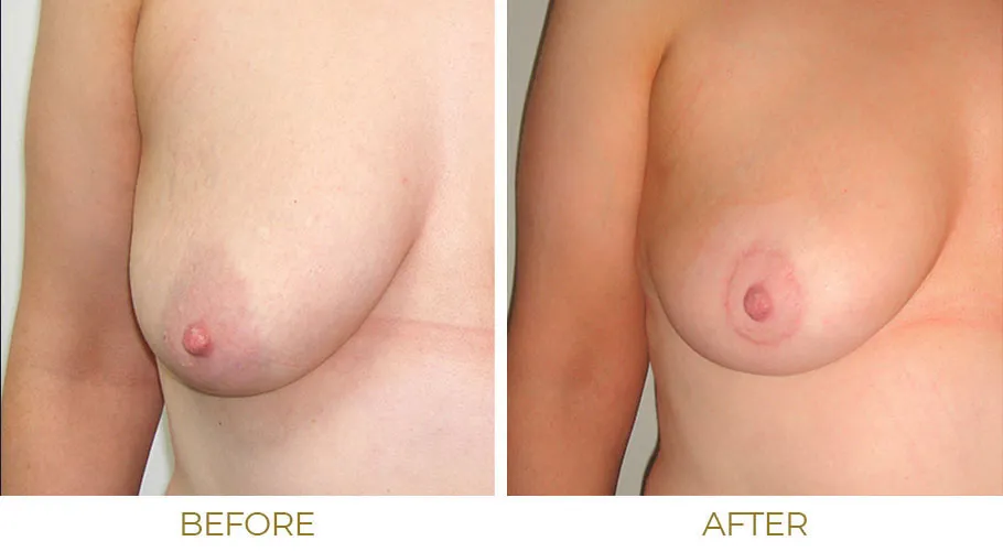 christal blake add women with small areolas photo