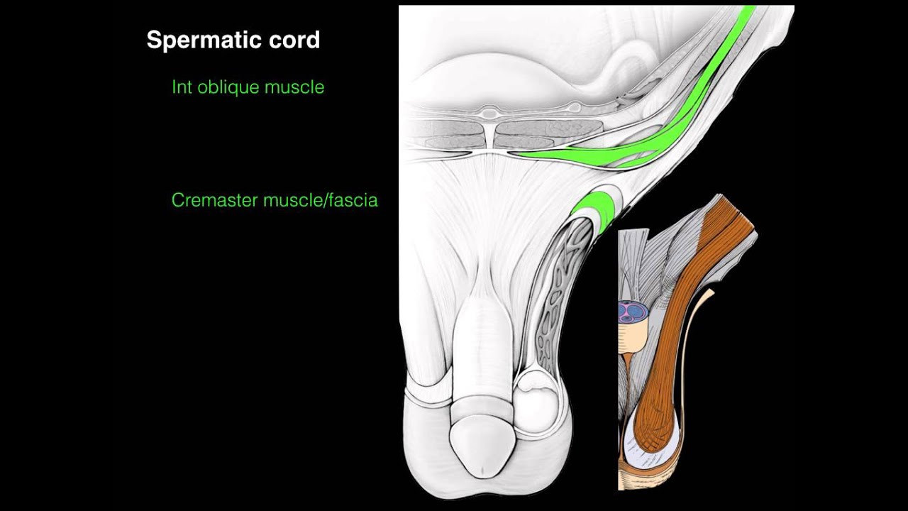 ch chand recommends inguinal canal tucking pic