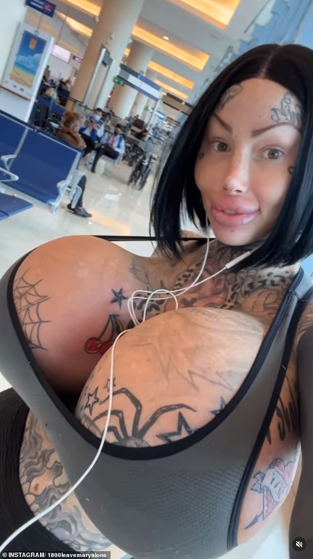andes lam recommends brittanya plastic surgery pic