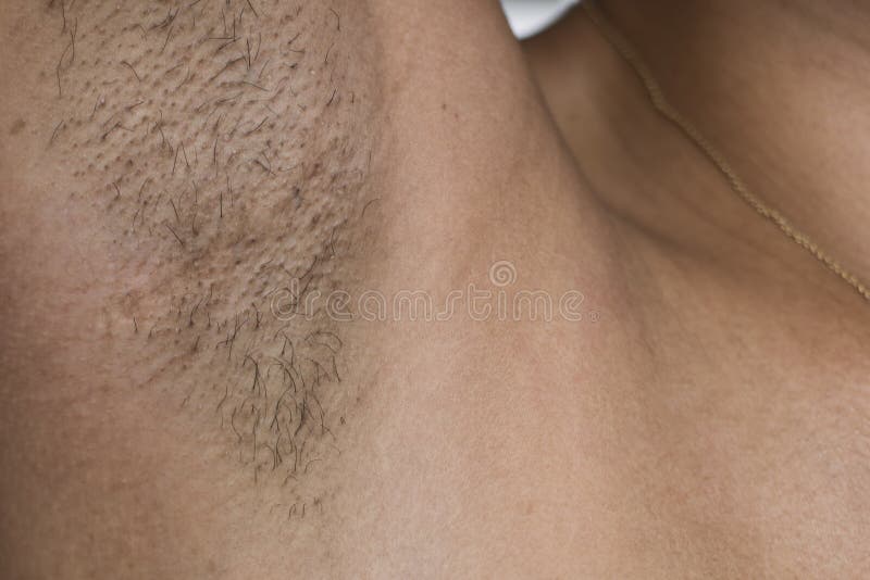 Www Hairy Women Com vk com