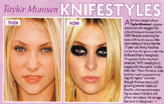 daizuke dark recommends Taylor Momsen Nose Job