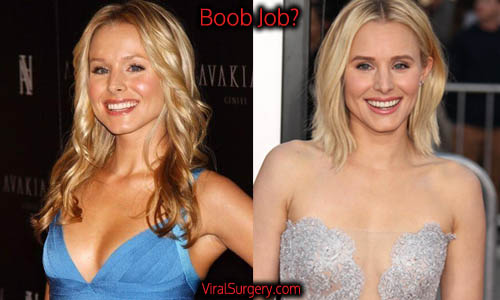 Best of Kristen bell fake boobs