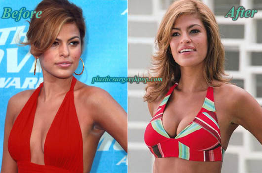 eva mendes boob job