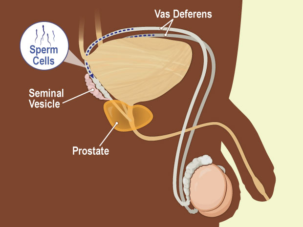 catherine ceballos recommends man forced to ejaculate pic