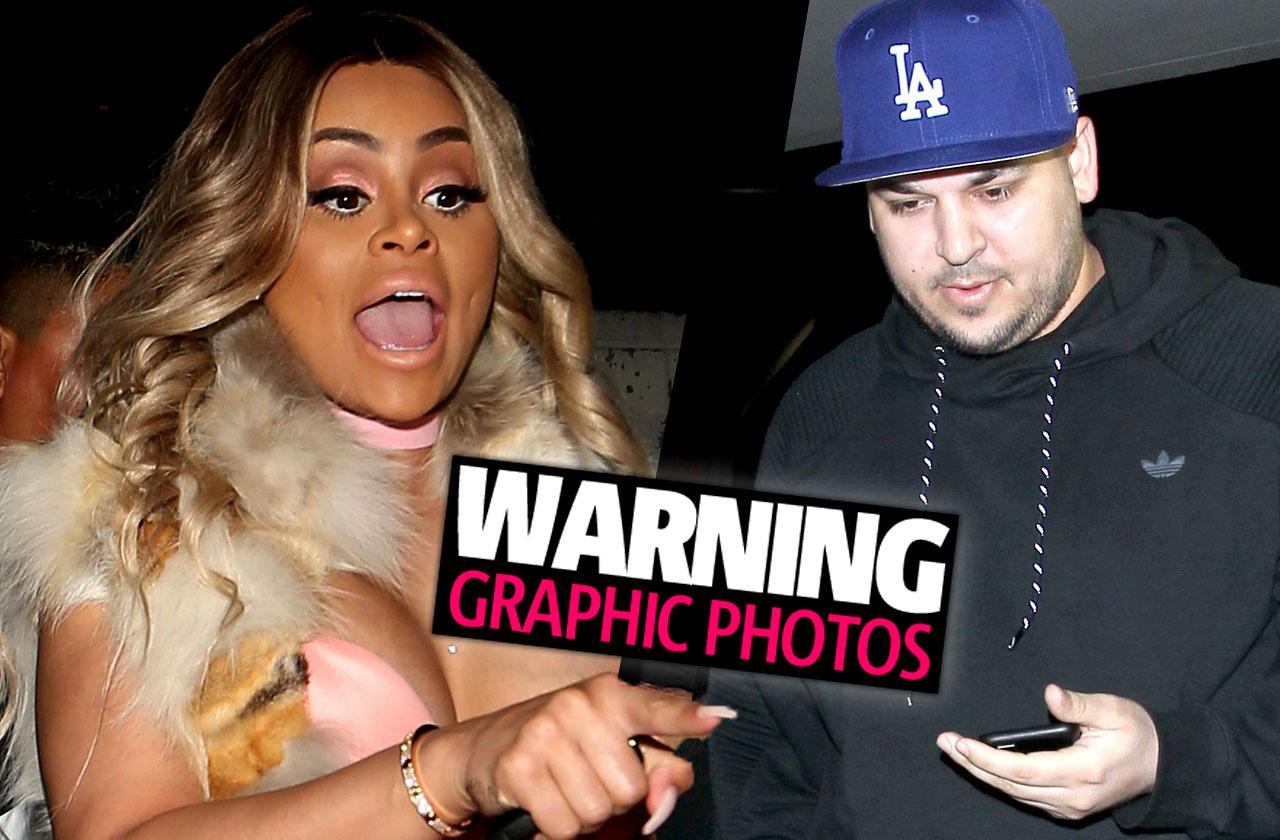 aghayerinmwinre uyi recommends Black Chyna Naked Photos