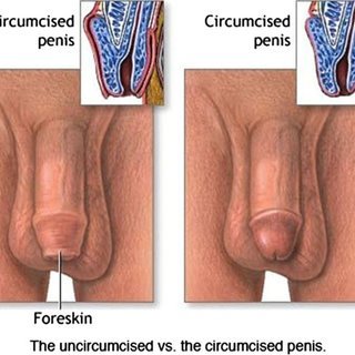 akintayo afeez recommends How To Masturbate Uncircumcised