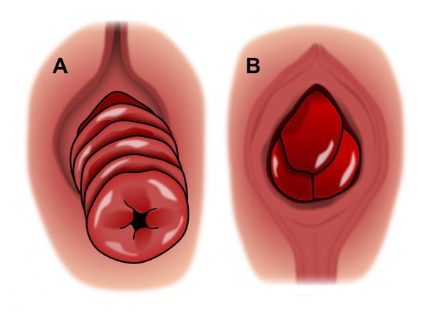 cj favela add photo how to stretch your ass hole