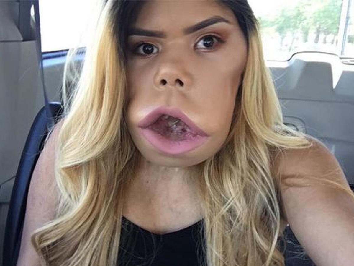 donna jo scott recommends youtuber with big lips pic