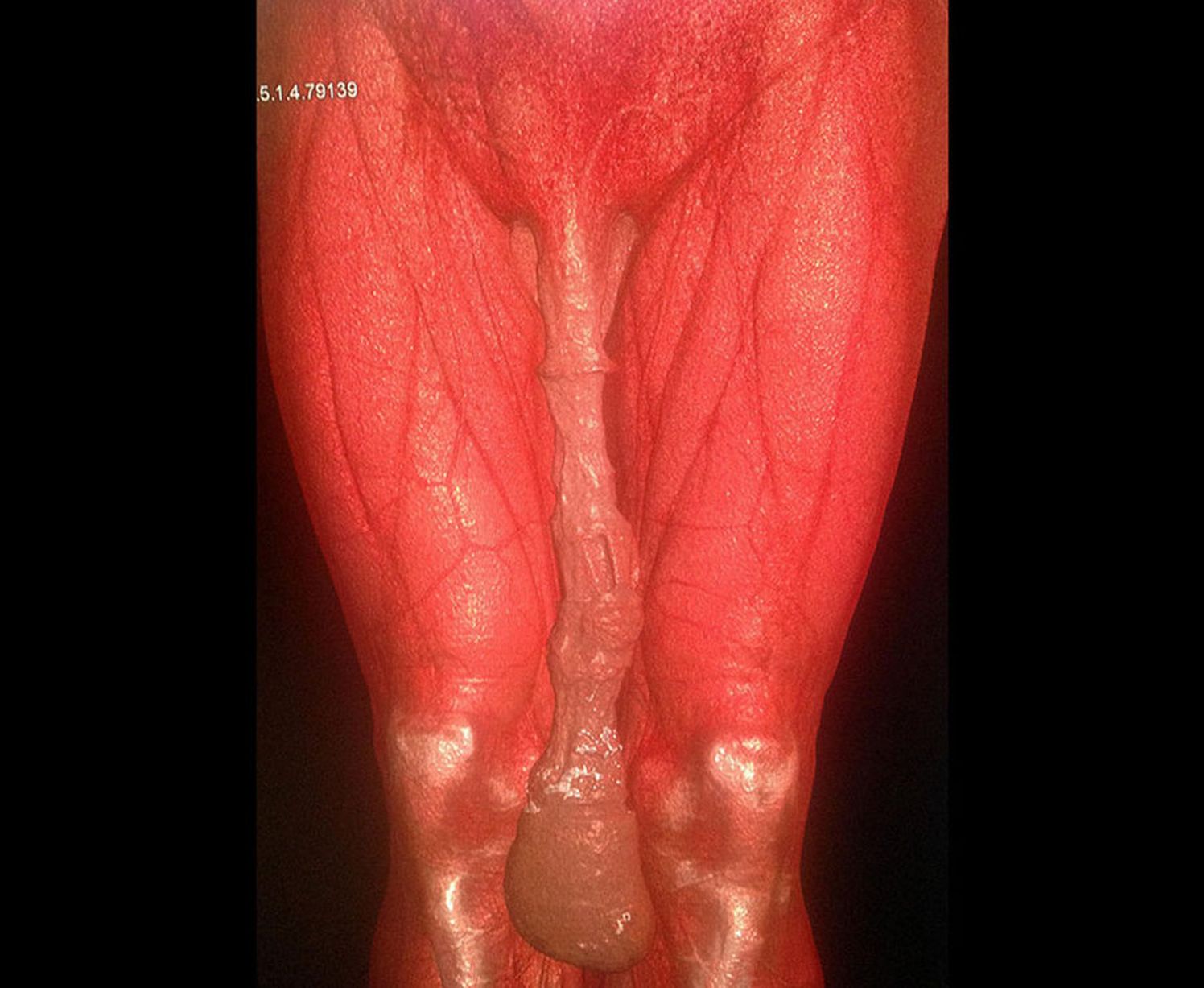 ario prakoso share worlds largest penis nude photos
