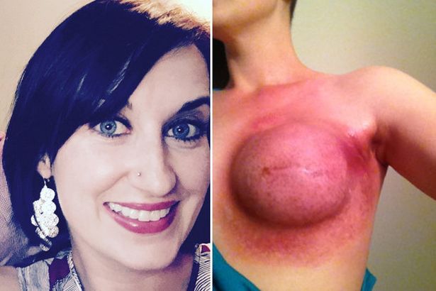 bernardo pascual recommends Breast Selfies Tumblr