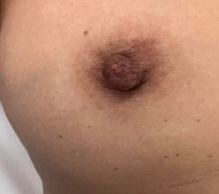 brandy napier recommends Breast Nipple Pic