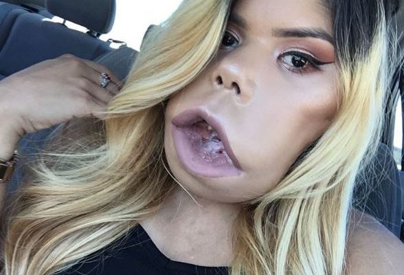 ashli weber recommends youtuber with big lips pic