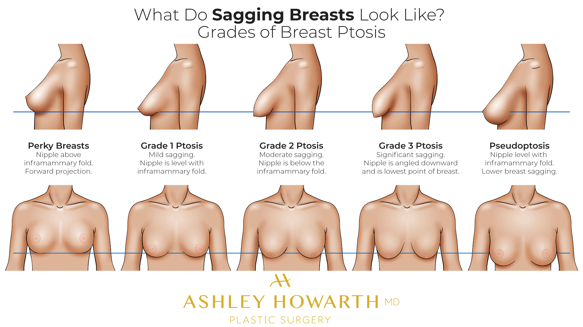 dhruba rai recommends nipple piercing saggy boobs pic