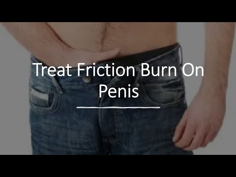 dhaya ananth recommends Friction Burn On Penis