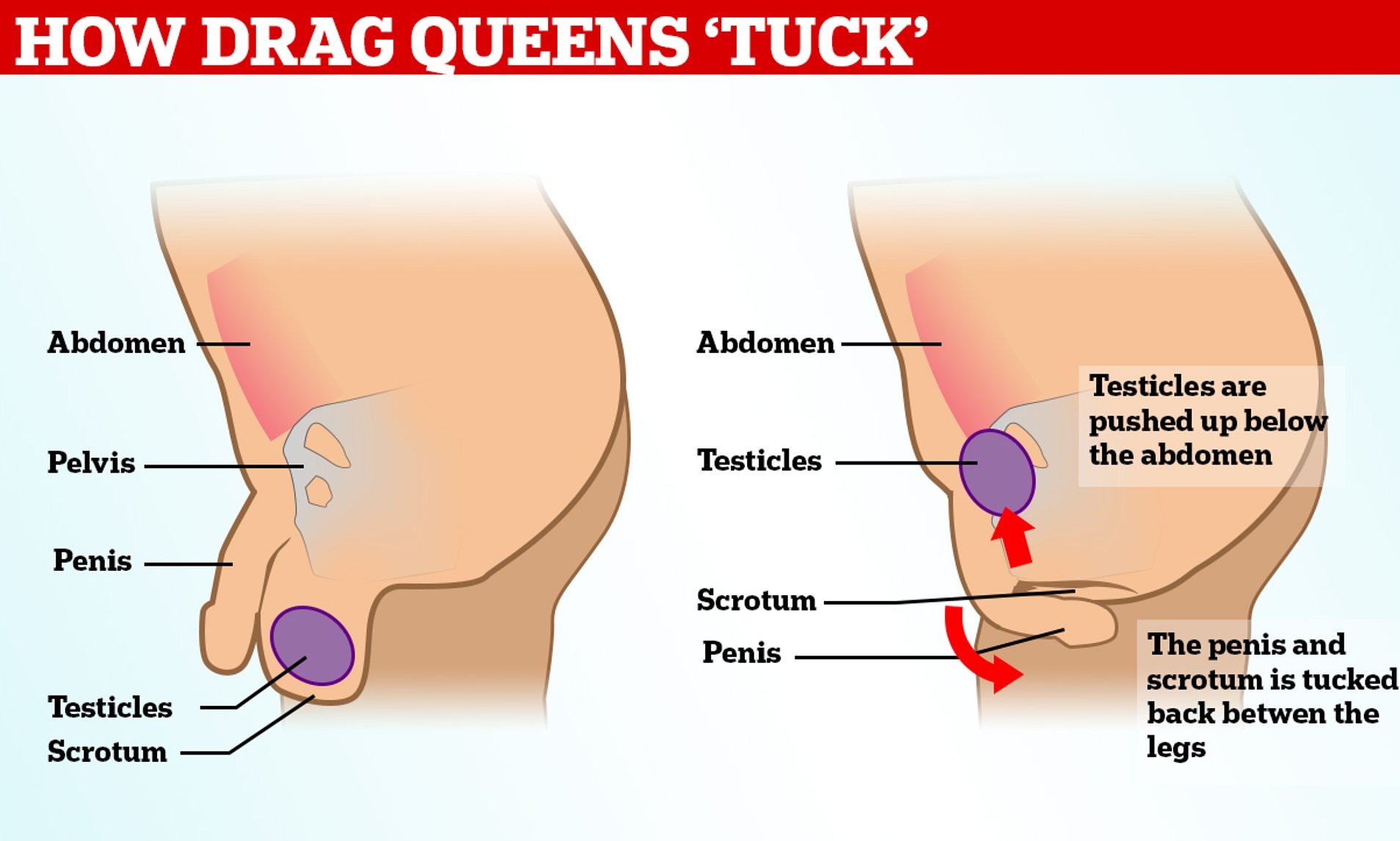 ajay gopinath recommends inguinal canal tucking pic