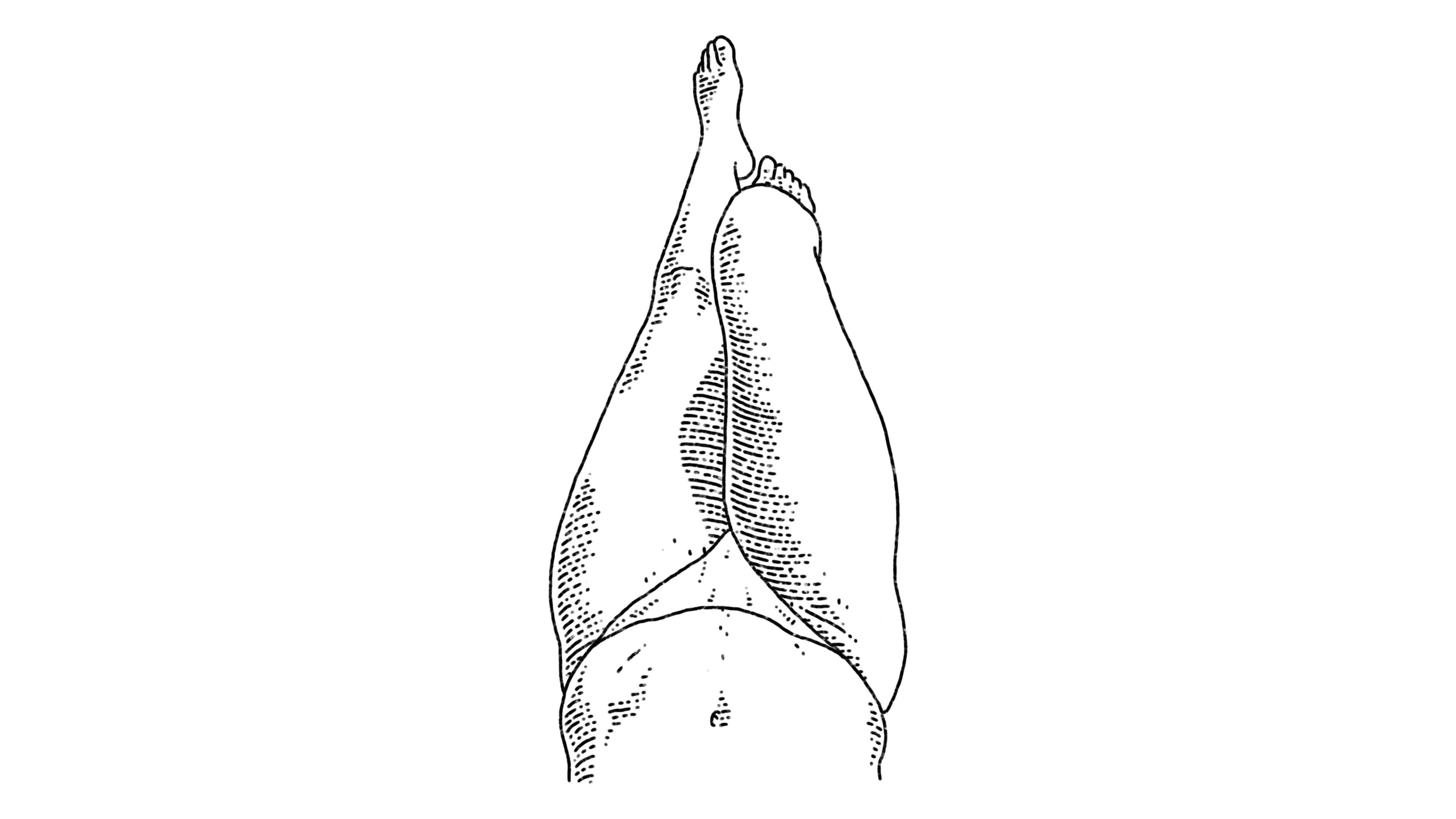 dominique derrick recommends inguinal canal tucking pic