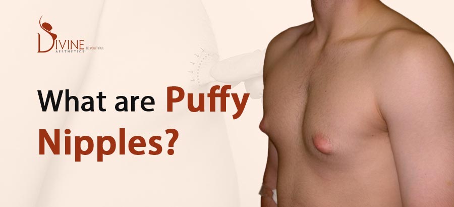 Best of Pictures of women with puffy nipples