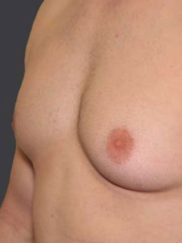 andres cavada add pictures of women with puffy nipples photo