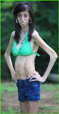 skinniest girl on earth