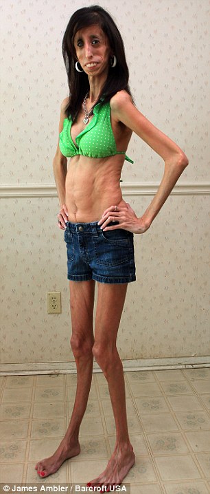 bryant heath add photo skinniest girl on earth