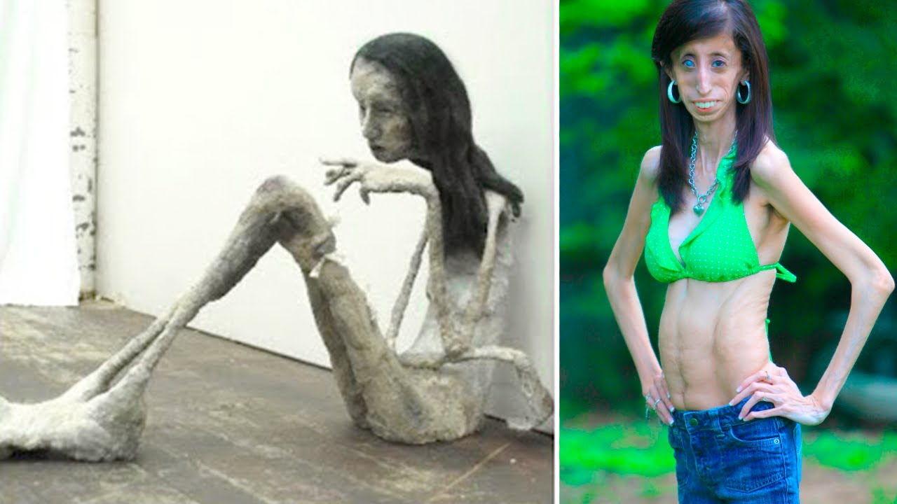 bianca de graaf recommends skinniest girl on earth pic
