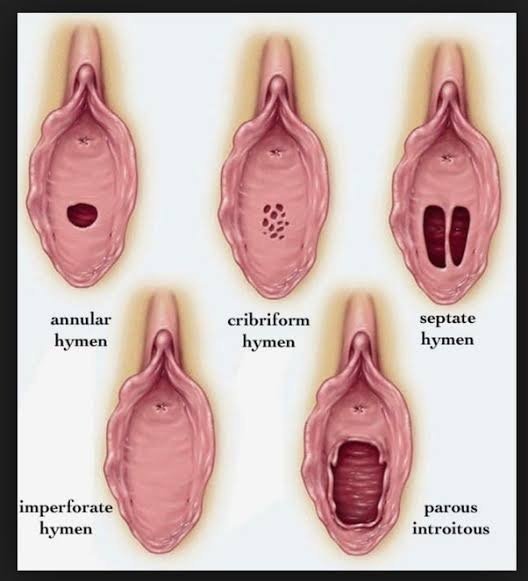 dorothy gauntlett share female anus close up