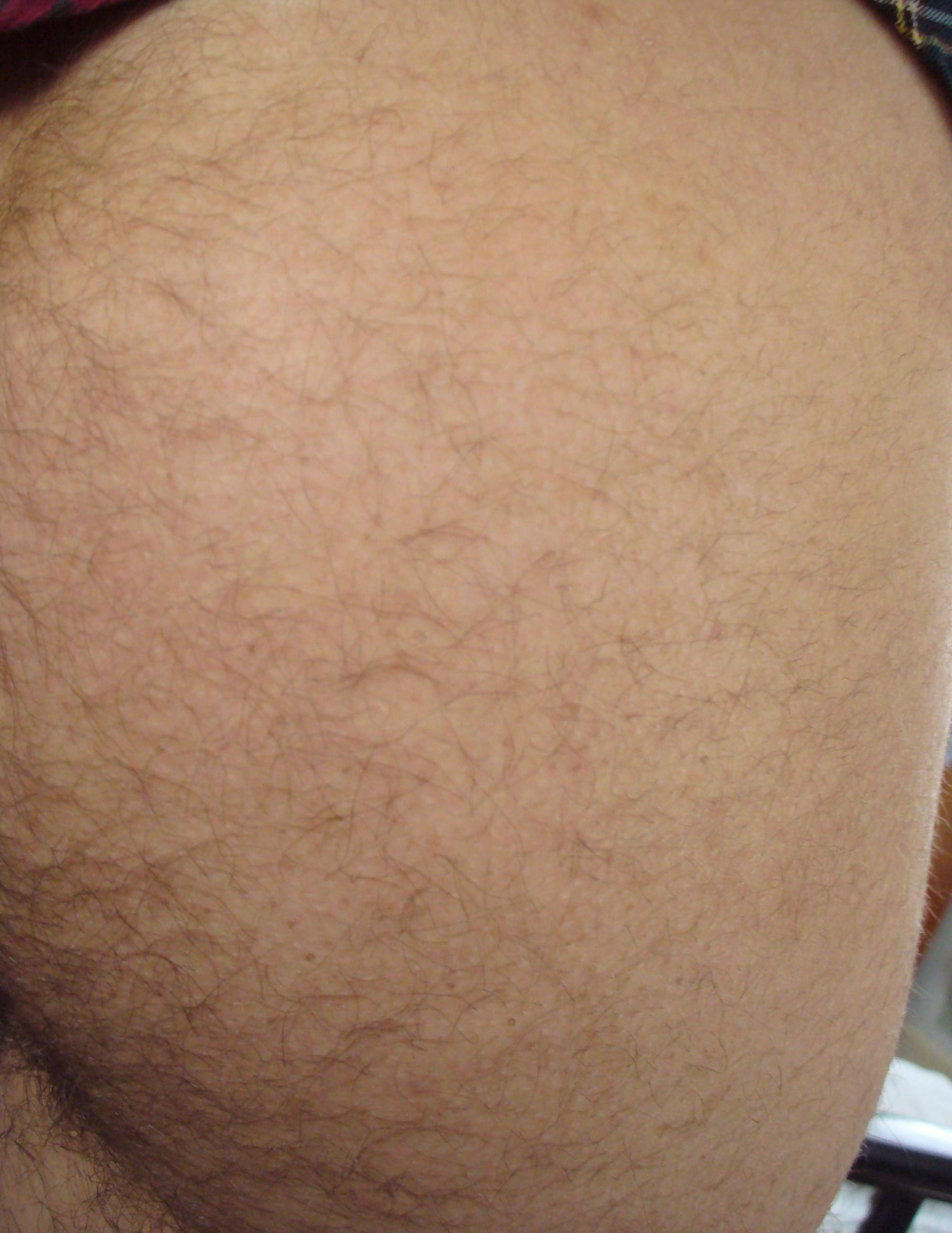 Best of Why is my butt so hairy