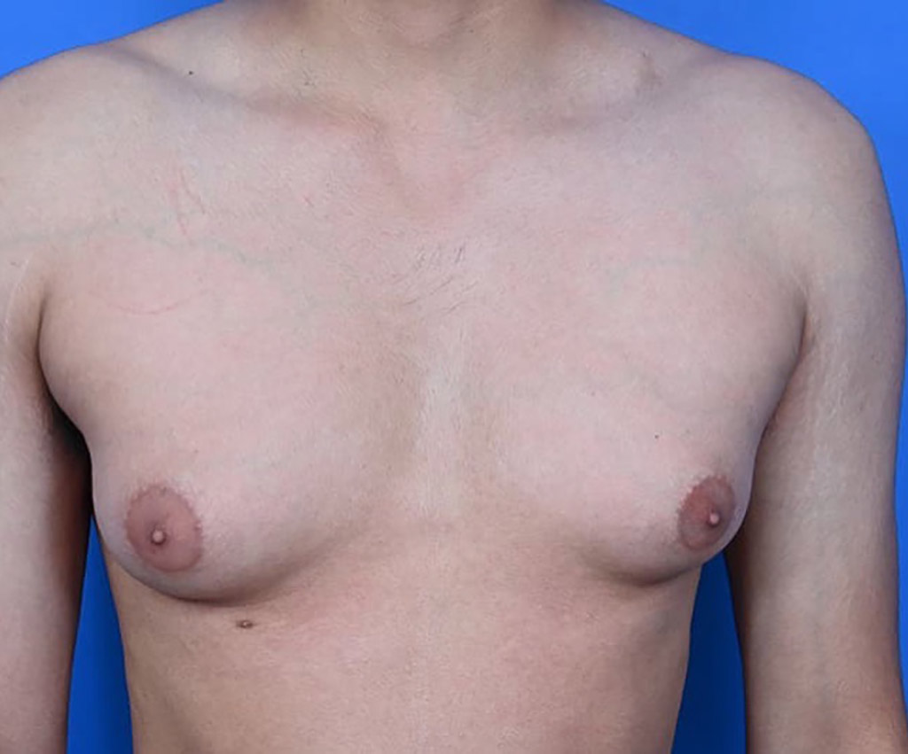 dave gerken recommends Women With Small Areolas