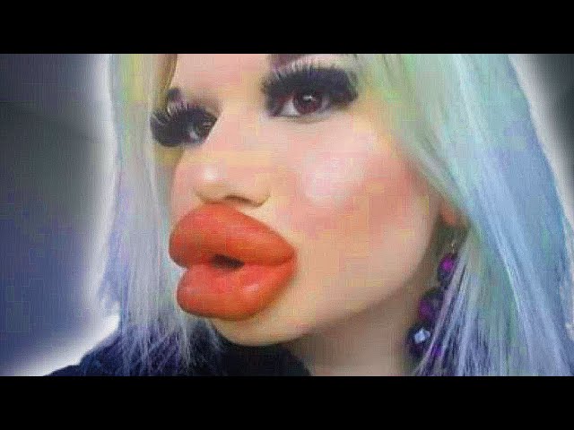 brandon deshong recommends youtuber with big lips pic